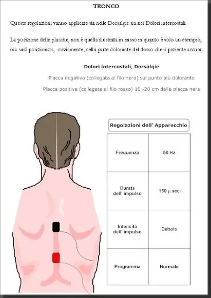 Applicazione della TENS: la corretta posizione degli elettrodi per ridurre il dolore.